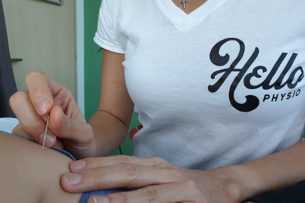 HelloPhysio Dry Needling in Singapore