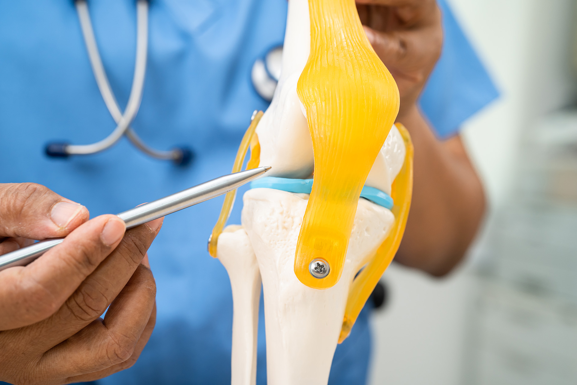 running knee pain