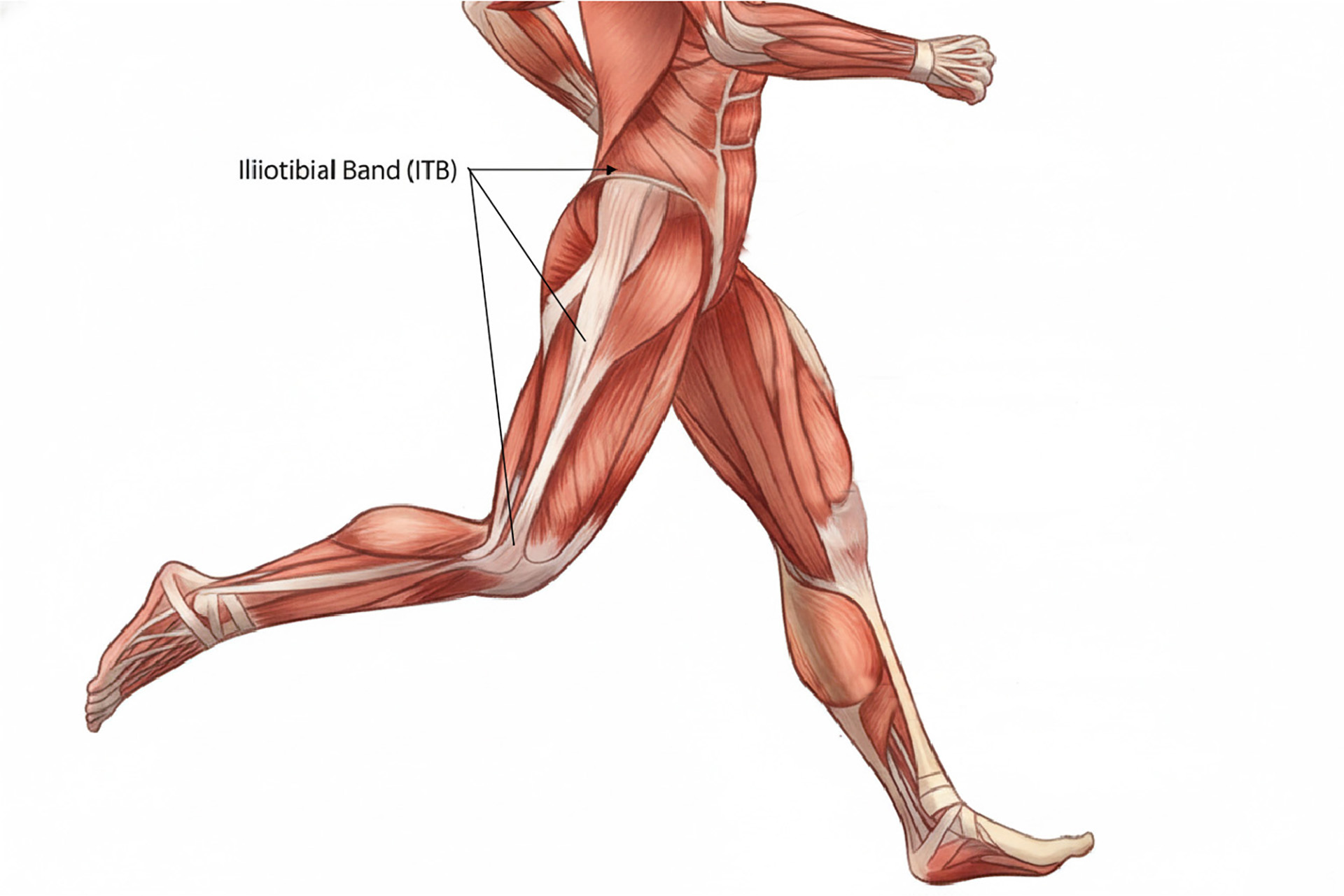 IT Band Syndrome running